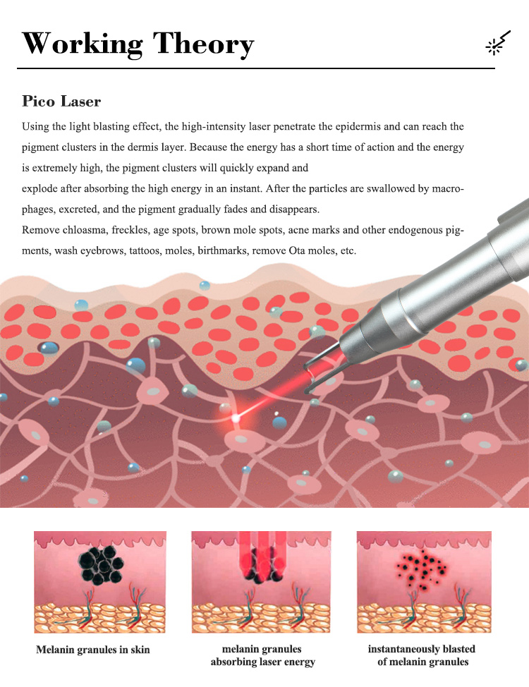 Nd Yag Laser Machine03